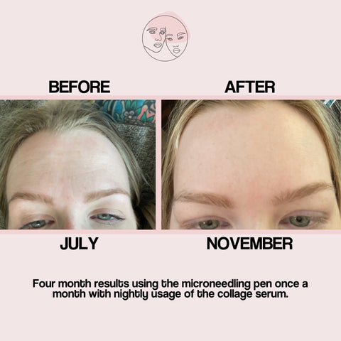 Before and After Image of Customer Using SolRay Beauty The Collagen Serum