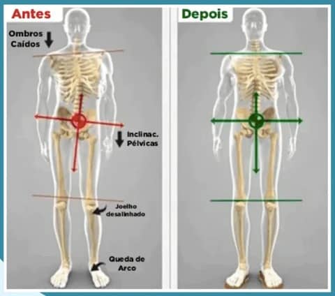 tenis ortopedico