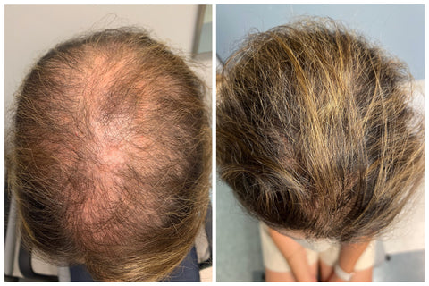 Fivfivgo™ Haarserum für dickeres