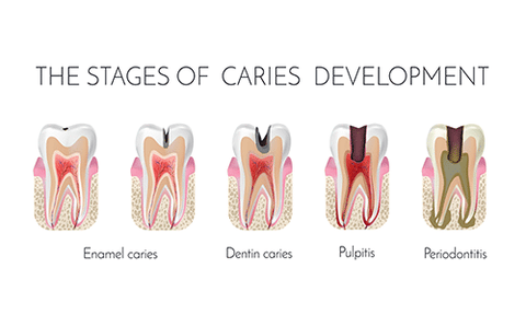 Cocomi™ Oral Care Pulling Oil - Solve All Oral Problems 