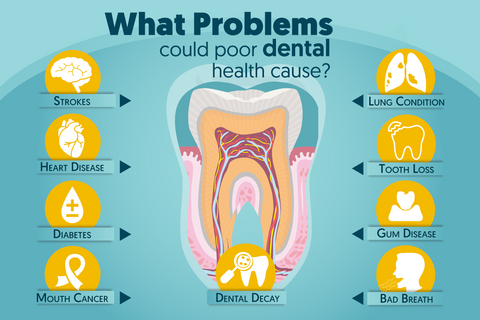 ENJUAGUE BUCAL TEETHAID™ y ELIMINACIÓN DE CÁLCULOS