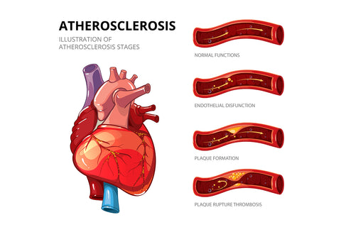 Causes for bad heart health