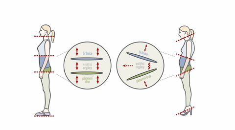 Podpatky mění náklon chodidla, a tím ovlivňují celé tělo.