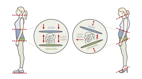 nákres toho, jak podpatky mění váš postoj. Žena v balerínkách stojí rovně, u ženy v lodičkách dochází k náklonu chodidel, pánve a bránice.