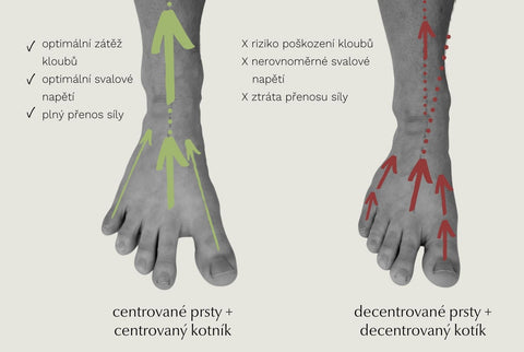 srovnání zdravě centrované nohy a nohy deformované běžnou obuví