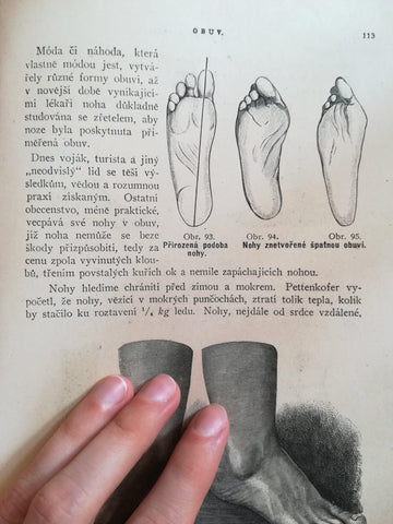stránka z knihy Žena lékařkou s ilustrací chodidla zmáčknutého v klasické botě