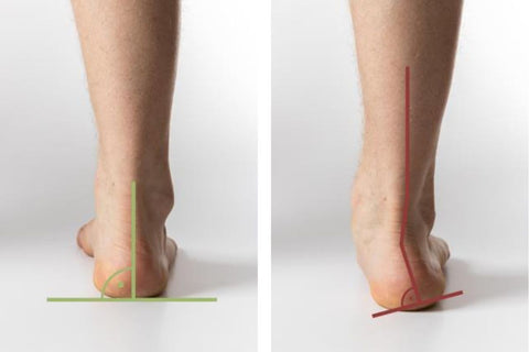 a photo of a leg that stands straight on the left , the heel is centred, a leg with the ankle turned in on the right, the heel is at an unnatural angle