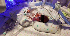 preemie baby in incuabtor