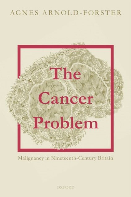 Cancer Problem: Malignancy in Nineteenth-Century Britain