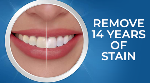 5D Teeth Whitening Strips 