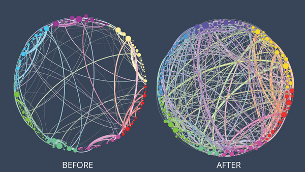 default brain network, psychedelics, connectivity, brain plasticity, psilocybin, magic truffles, amsterdam, free shiopoing, when nature calls, microdosing, benefit, health, medicinal, tripping