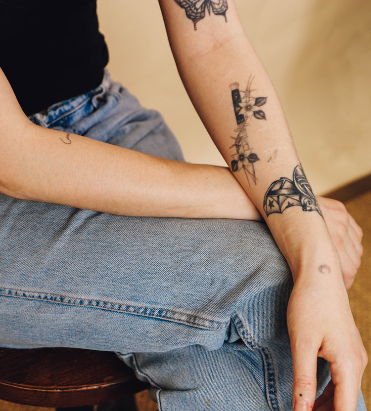 Does laser tattoo removal leave a scar  Inkfree MD