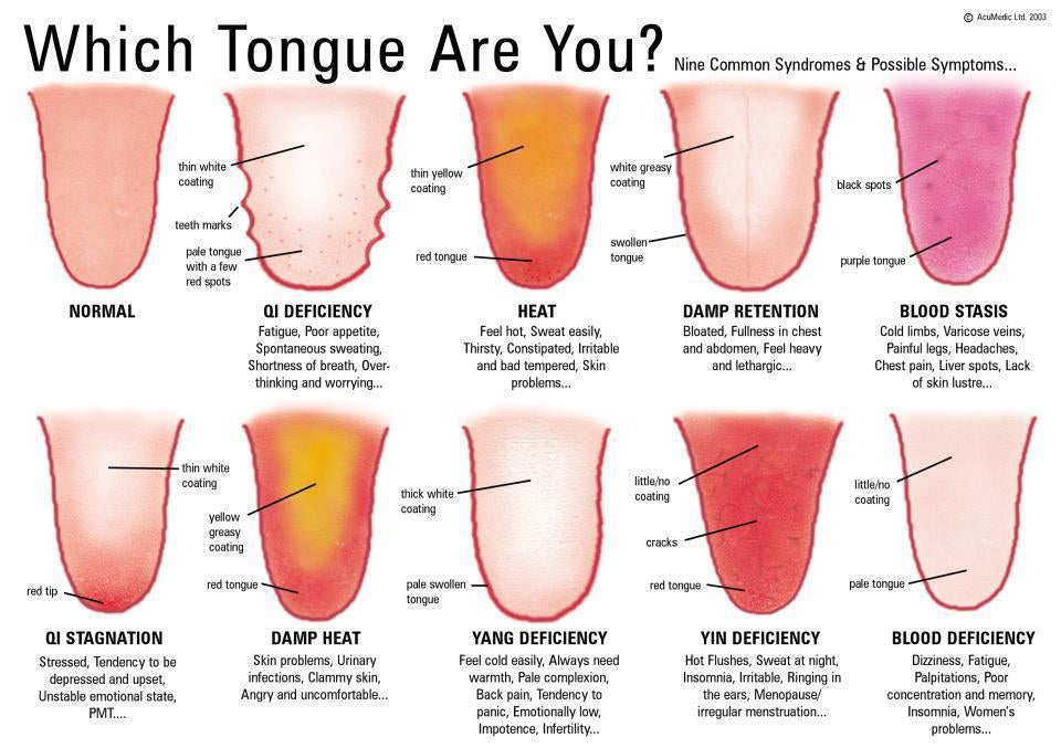 CausalityCare.com “Ayurveda Holistic Wellness & Pain Management Specialist”  Ayurvedic Tongue Analysis