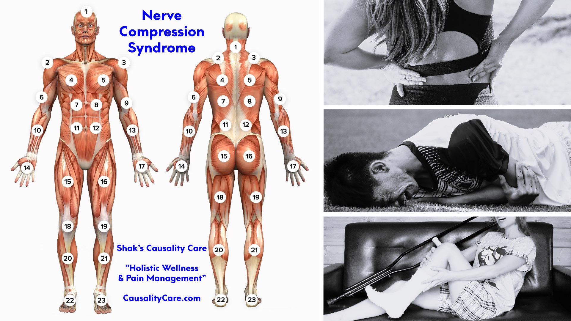 Shak's Causality Care | What is Nerve Compression Syndromes? | CausalityCare.com