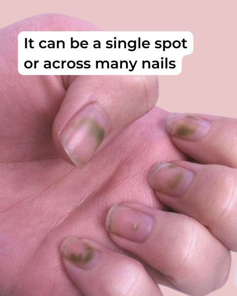 Are long nails health hazards? Experts weigh in on bacteria, fungi