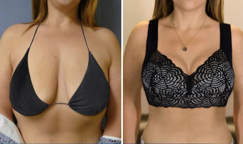 Slimming Breast Enlargement Underwear Lymphatic Detoxification Shaping & Strong Lifting Gathering Bra