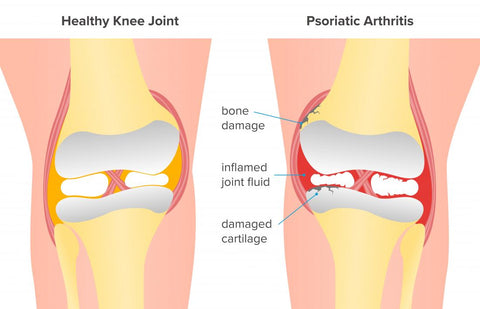 Activeme™ Joint & Bone Therapy Spray