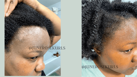 HAIR GROWTH, HERBAL HAIR PRODUCTS, REGROW EDGES