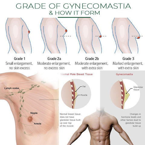 SlimBody Gynecomastia Compression Top 
