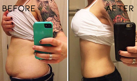 Oveallgo™ BurnUp Belly Shaping Patches