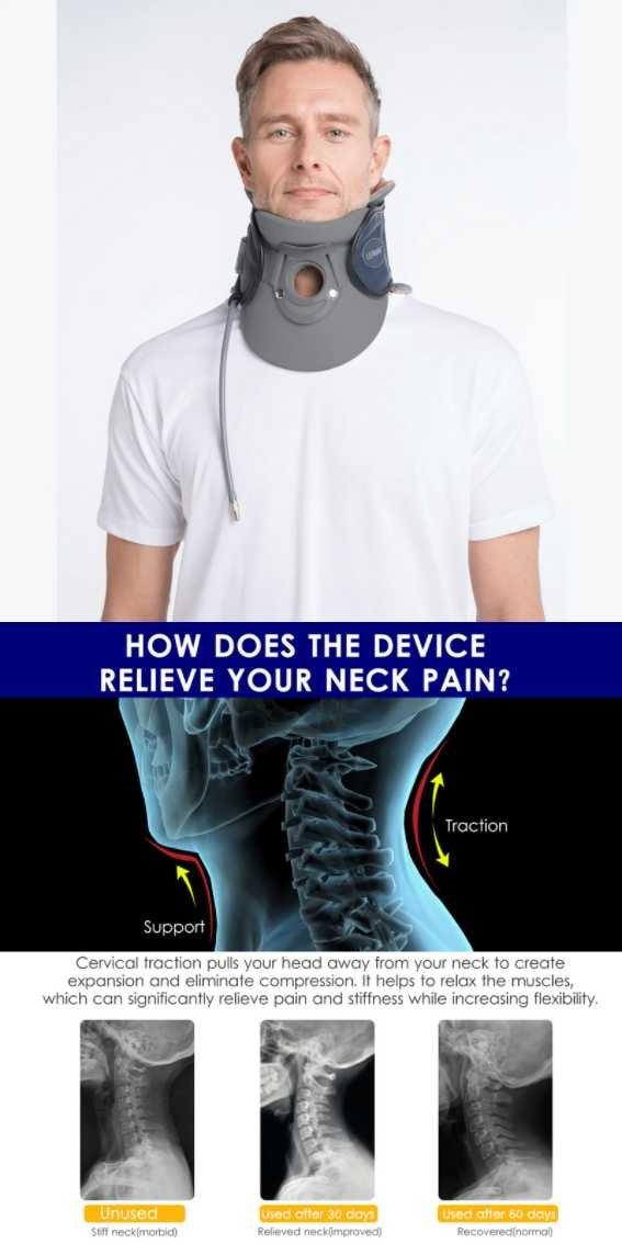 pinched nerve in neck treatment at home