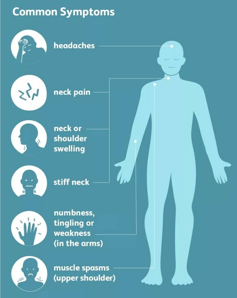 symptoms and causes of neck pain and pinched nerve