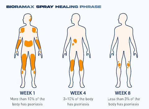 BIORAMAX PsoriaRescue Treatment Spray