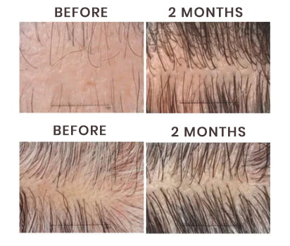 Densifique Hair Growth ፎርሙላ የሴረም ስፕሬይ