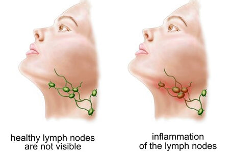 VivoraZeneca™ EMS Neck AcupunctureMassager