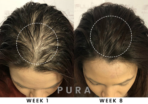 PURA Hair Reborn Biotin Shampoo