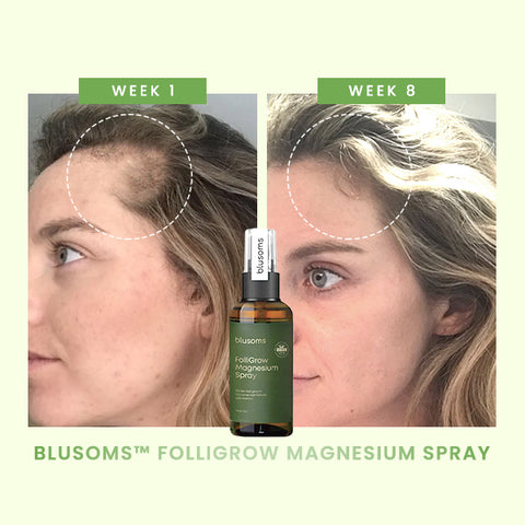 Blusoms™ FolliGrow Magnesium Serum Spray