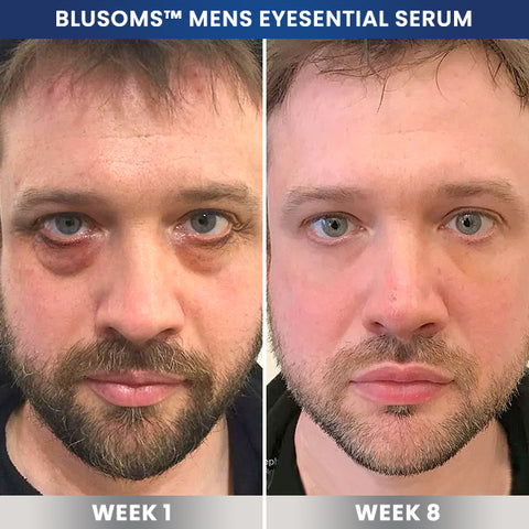 Blusoms™ Vita Mens Eyesential Serum
