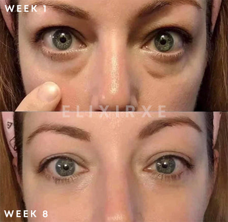 ElixirXE Nutriperfect Eye Serum