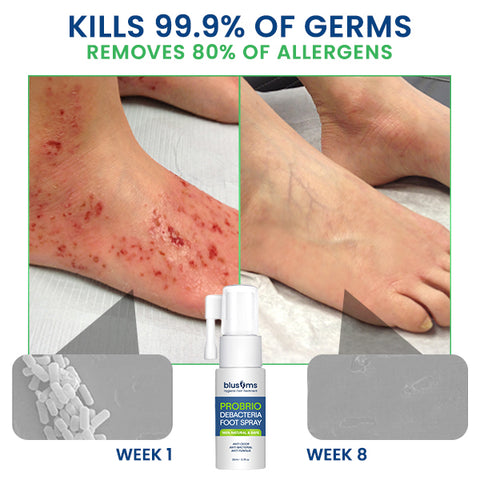 Blusoms™ PROBRIO Debacteria Foot Spray
