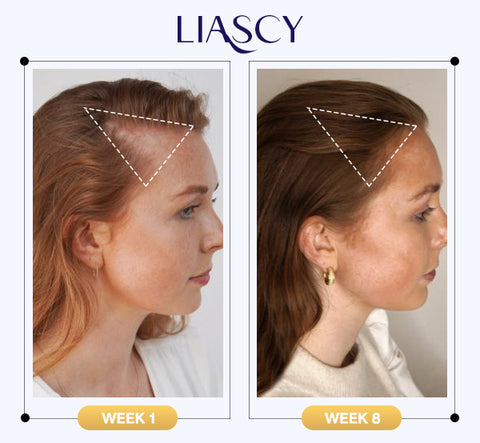 Kalafo ea Liascy™ Shine Anti-Thinning