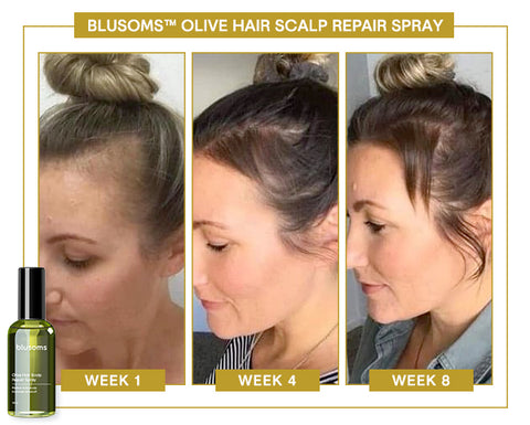 Blusoms™ Olive Hair Scalp-Repair Spray