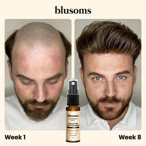 Blusoms™ Root Activator Spray