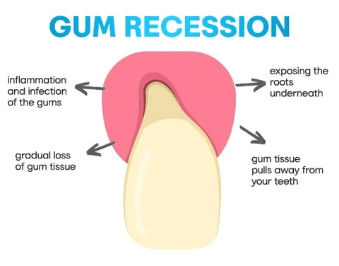 Gum Pen Liascy™ GingivaEase