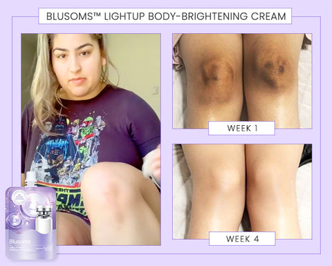 Blusoms™ LightUp Body-Brightening Cream