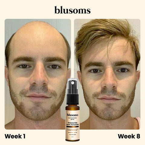 Blusoms™ Root Activator Spray