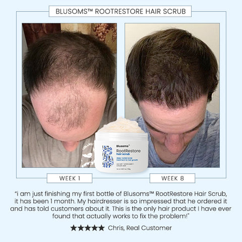 Blusoms™ Luscious RootRestore Hair Scrub
