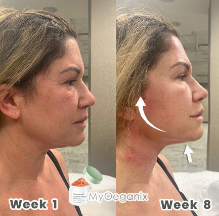 MyOeganix Lines Gone Neck-Gel 