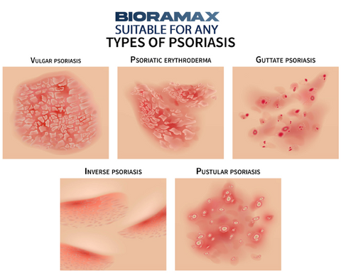 BIORAMAX PsoriaRescue Treatment Spray