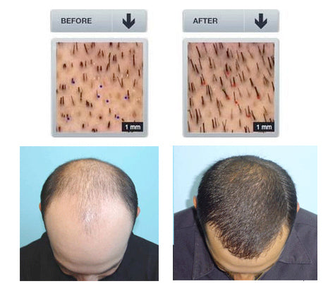 สเปรย์เซรั่มสูตร HairGrowth Densifique