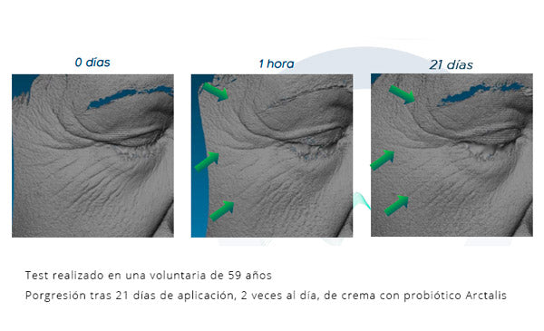 El probiótico Arctalis, el aliado en el rejuvenecimiento de tu piel