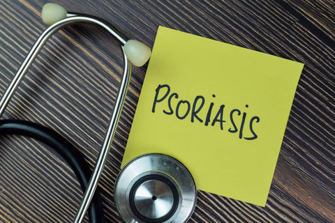 psoriasis