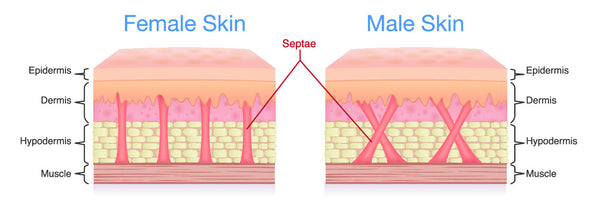 What is cellulite and it's structure