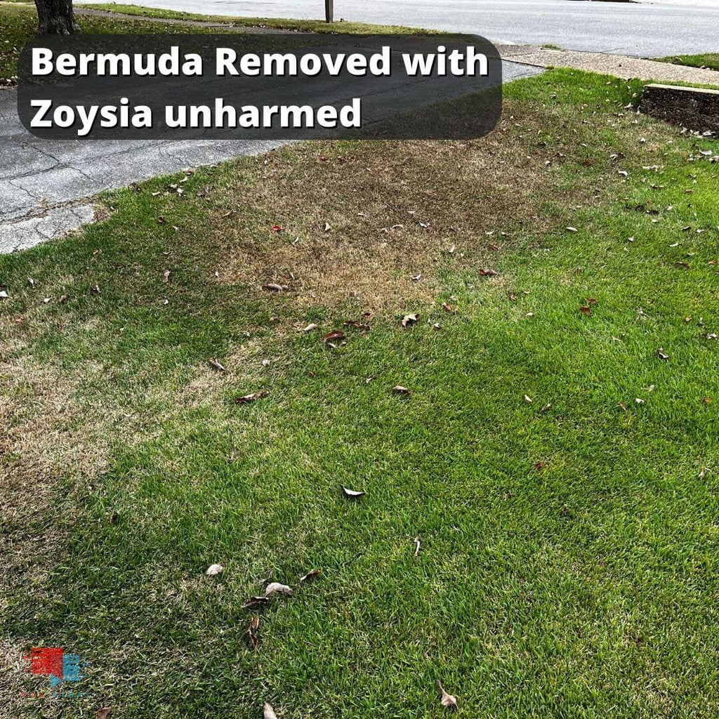 bermuda removed and zoysia unharmed