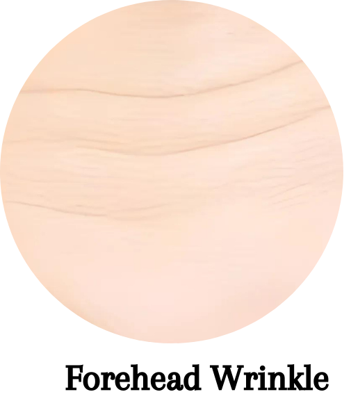 Forehead Wrinkles