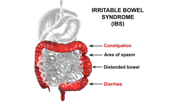Diagram showing IBS symptoms in intenstine